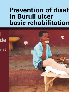 The guide contains valuable tools for wound care and the rehabilitation of people affected by Buruli ulcer. 