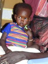 A child with SAM and medical comlications receiving treatment at stablization center in Juba PoC