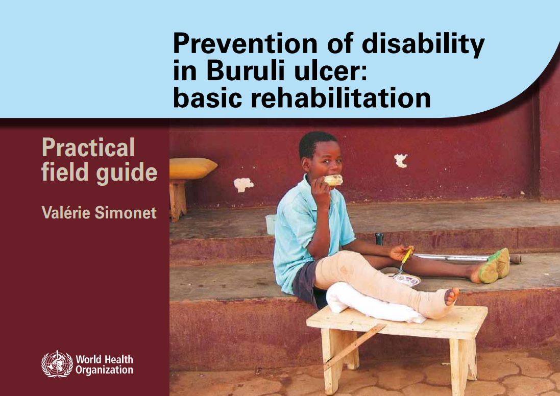 The guide contains valuable tools for wound care and the rehabilitation of people affected by Buruli ulcer. 