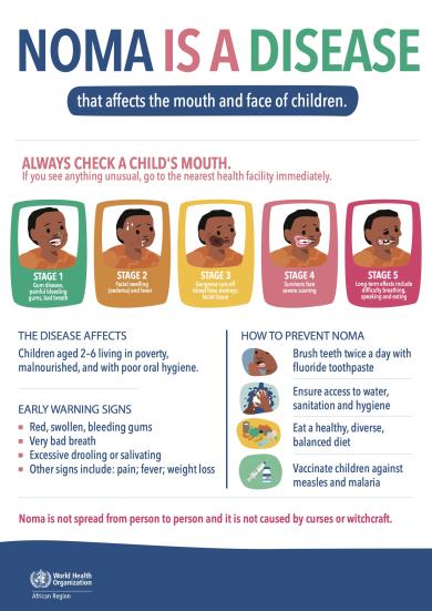 Poster for raising awareness and promoting early detection of noma