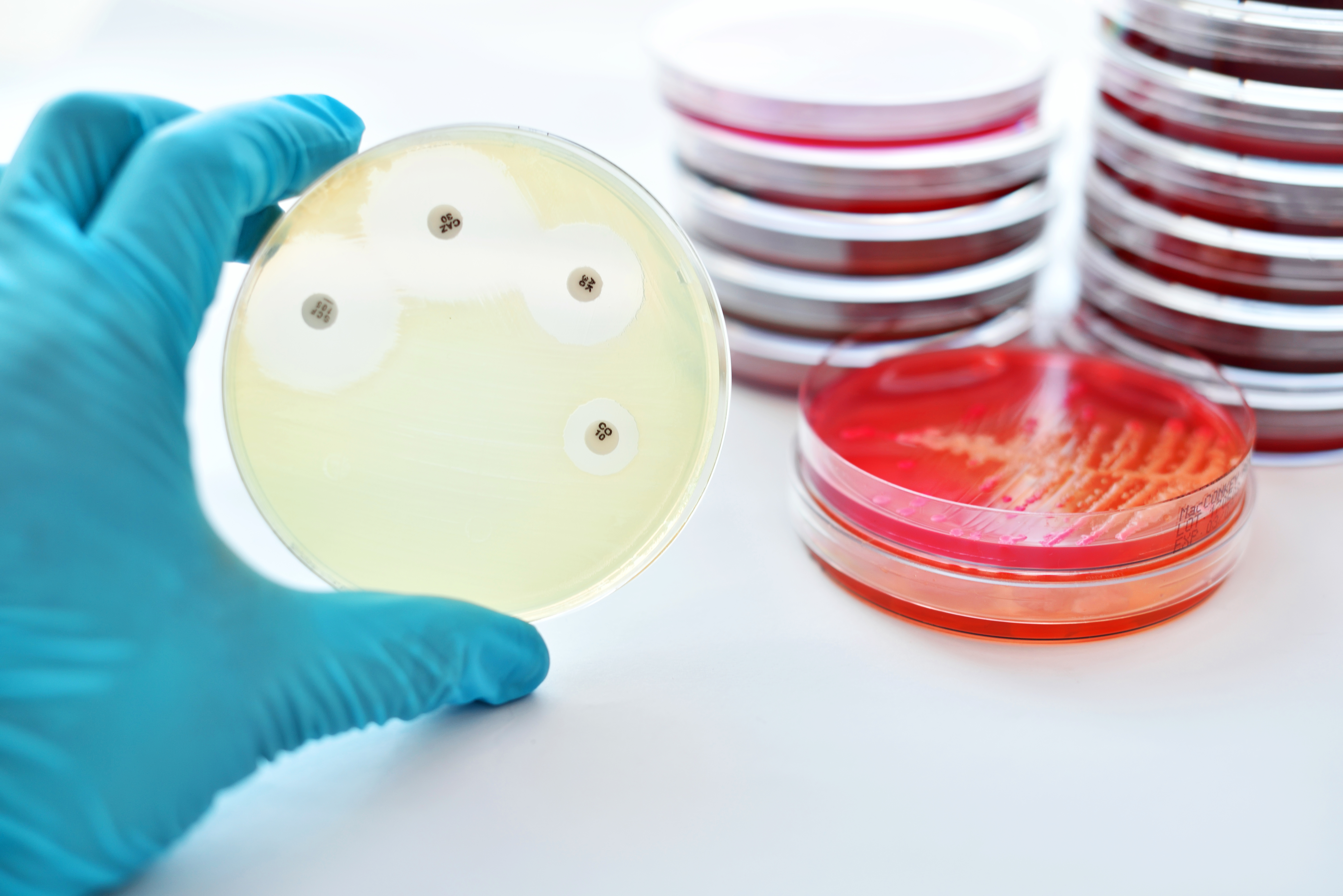 Combating antimicrobial resistance