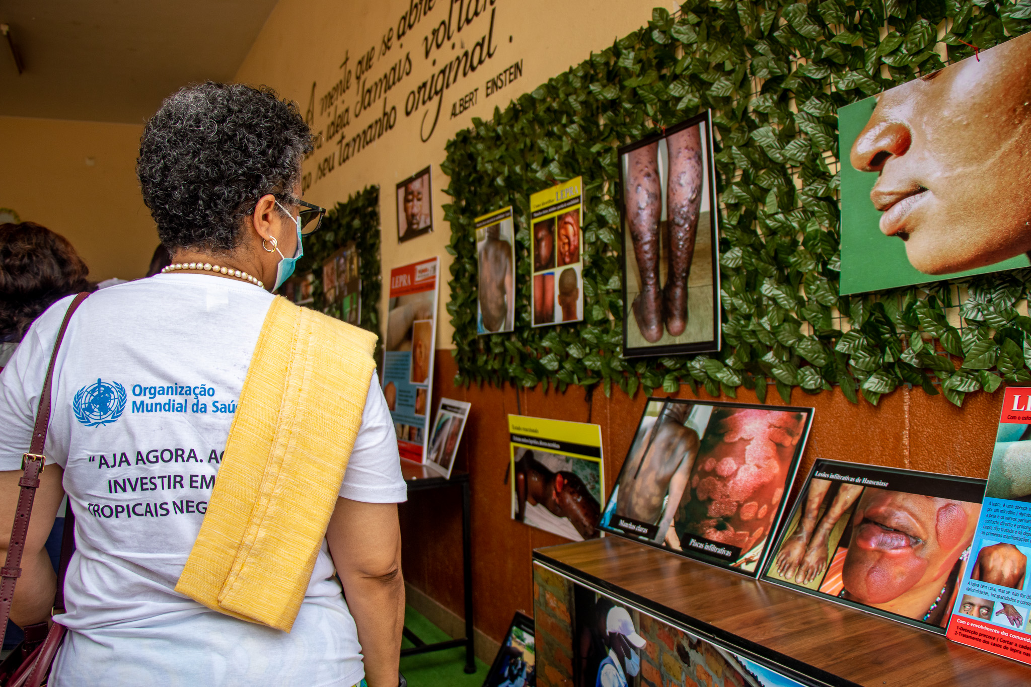 ​ Exhibition on NTDs in Angola ​