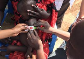 A medical personnel measures a child's middle upper arm circumference (MUAC) to check for malnutrition.  A color-coded MUAC band is a simple tool for screening children for acute malnutrition. Photo: WHO.