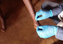 Scaling up response tåo curb growing mpox outbreak in African region