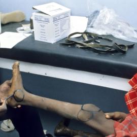 Injuries