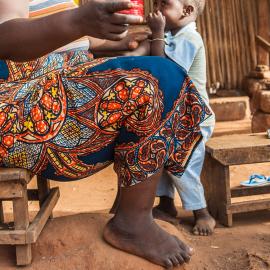 Lymphatic filariasis