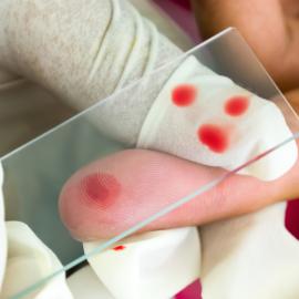 Malaria