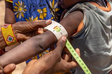 Screened for malnutrition by a mobile health team