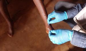 Scaling up response to curb growing mpox outbreak in African region