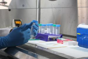 Strengthening laboratory capacity revolutionizes TB treatment in Congo