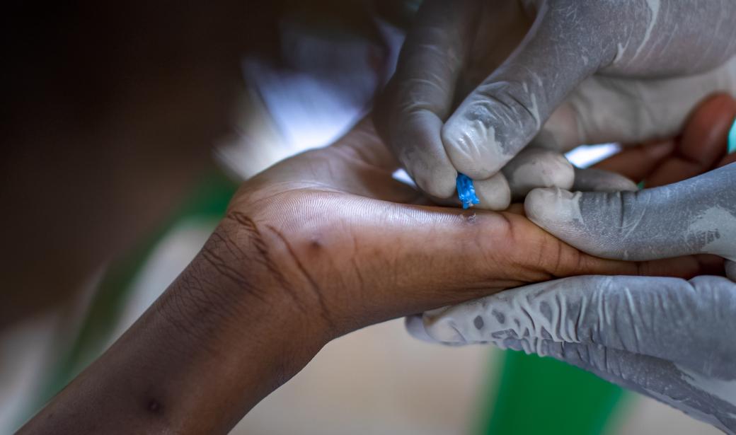 Renforcer les systèmes de riposte aux épidémies pour contenir la propagation de la mpox en Ouganda